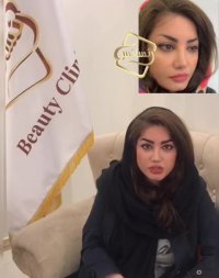 کاشت ابرو_تکنیک جدید کاشت ابرو کلینیک رنسانس