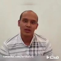 کاشت موی طبیعی در کلینیک تخصصی رنسانس