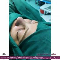 فیلم جراحی بینی نیمه فانتزی