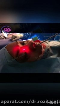 جراحی سینوس و پروپتوز خفیف.