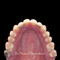 دکتر داودیان | متخصص ارتودنسی