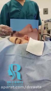 فیلم جراحی بینی گوشتی دکتر نسرین راستا