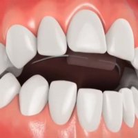 یک دستگاه عادت شکن