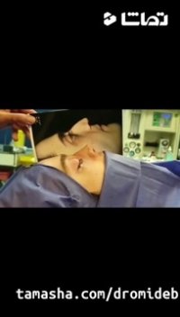 جراحی انحراف شدید بینی توسط بهترین جراح بینی دکتر امید ابراهیمی