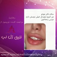 فیلم رضایت مراجعه کننده عزیز از تزریق ژل لب