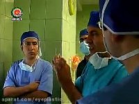 پروفسور کشکولی فوق تخصص جراحی پلاستیک و ترمیمی چشم