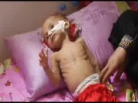 هر ده دقیقه یک کودک یمنی جان می دهد