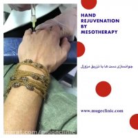 جوانسازی دست با تزرق مزوژل