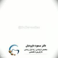 قبل و بعد ارتودنسی با کشیدن دندان | دکتر داوودیان