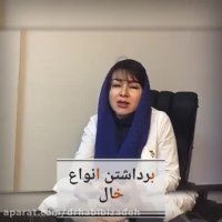 برداشتن انواع خال