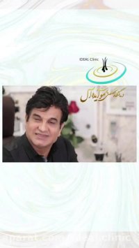 فیلم کاشت مو برای خانم ها