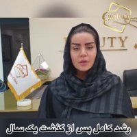 فیلم کاشت ابرو -کلینیک تخصصی رنسانس