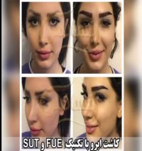 کلینیک تخصصی پوست و مو رنسانس