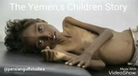 فیلمی درباره وضعیت اسف بار میلیون کودک یمنی