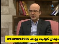 درمان کولیت روده (اولسراتیو)