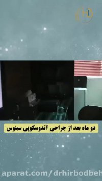 معاینه بیمار دوماه بعد از جراحی آندوسکوپی سینوس