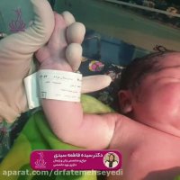 فیلم زایمان سزارین