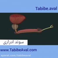 سوند ادراری