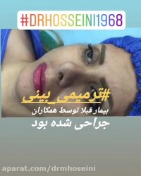 جراحی ترمیمی بینی- دکتر محمدعلی حسینی