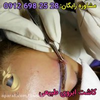 کاشت ابرو طبیعی | کلینیک لیان | 02188978829