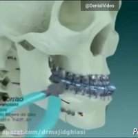 مشکلات فک ودندان-دکترمجیدقیاسی دندانپزشک زیبایی مشهد