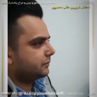 فیلم جراحی بینی مردانه