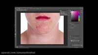 از بین بردن جوش های صورت در فتوشاپ