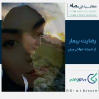 نتیجه جراحی بینی توسط دکتر بصام