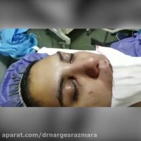 جراحی زیبایی بینی