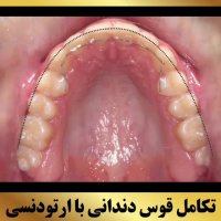 ارتودونسی شرق تهران | دکتر داوودیان