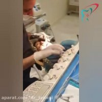 درمان ۸ واحد ونیر کامپوزیت