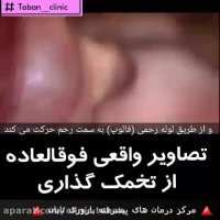 فیلم روند تخمک گذاری