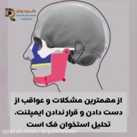 عوارض نداشتن دندان