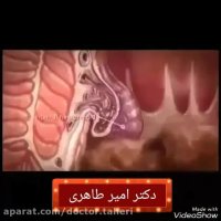علل شایع بواسیر | دکتر امیر طاهری