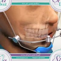 دستگاه فیس ماسک ارتودنسی | دندانپزشکی سیمادنت