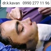 عمل بینی توسط دکتر کاوان