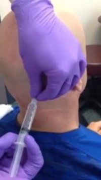 بلوک عصب اکسی پوت