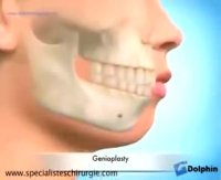 جراحی فک و ارتودنسی | دکتر مسعود داودیان