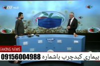 چه عواملی باعث ایجاد کبدچرب می شود؟