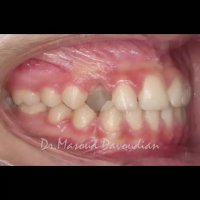 ارتودنسی تهران | دکتر داوودیان