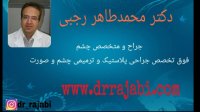 بلفاروپلاستی(جراحی زیبایی پلک)