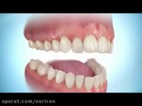 مراحل ارتودنسی دندان