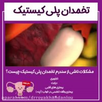 مشکلات ناشی از سندرم تخمدان پلی کیستیک