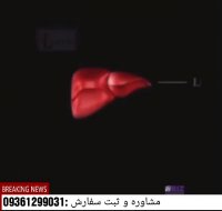 فواید مصفی خون برای درمان کبد چرب