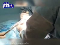 هدف از جراحی تعویض مفصل زانو