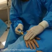 فیلم تزریق چربی به دست