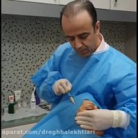 فیلم تزریق چربی به صورت جهت جوانسازی و حجم دهی صورت