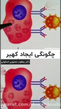 فیلم چگونگی ایجاد کهیر