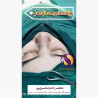 بلافاصله بعد از اتمام عمل بینی