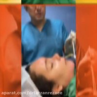 تزریق چربی به پیشانی و چانه همزمان با جراحی بینی